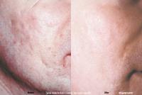 Huntington Dermatology & Cosmetic image 7